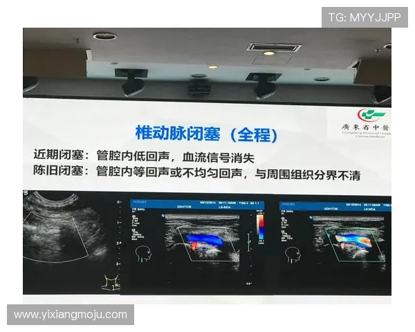 布尔格与索肖的对决分析及双方近期状态评估